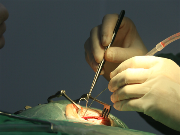 人工耳蜗手术现场图术后第三天,刚好是儿童节,王龙海主任为孩子送去