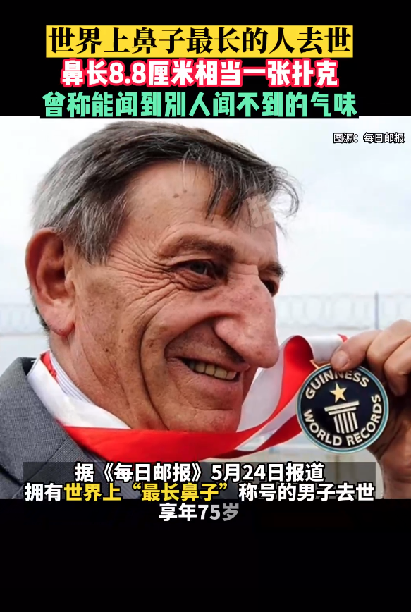 世界上鼻子最长的人去世了鼻长88厘米相当一张扑克曾称能闻到别人闻不