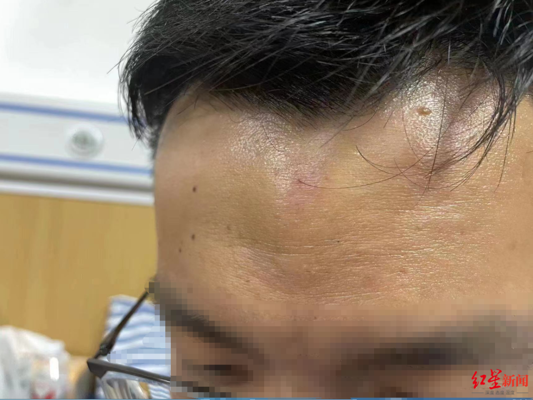 记者采访被打视频_记者采访遭殴打_殴打遭采访记者怎么处理