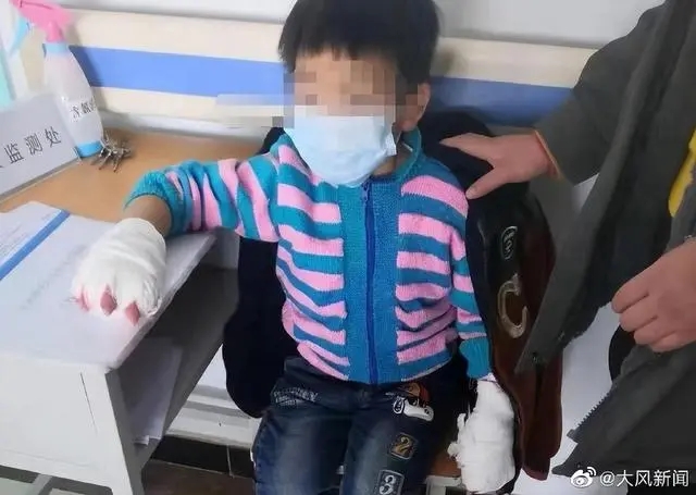 残疾人被父母抛弃_残障女子被父母抛弃完整版_继母涉嫌虐待继女致其残疾