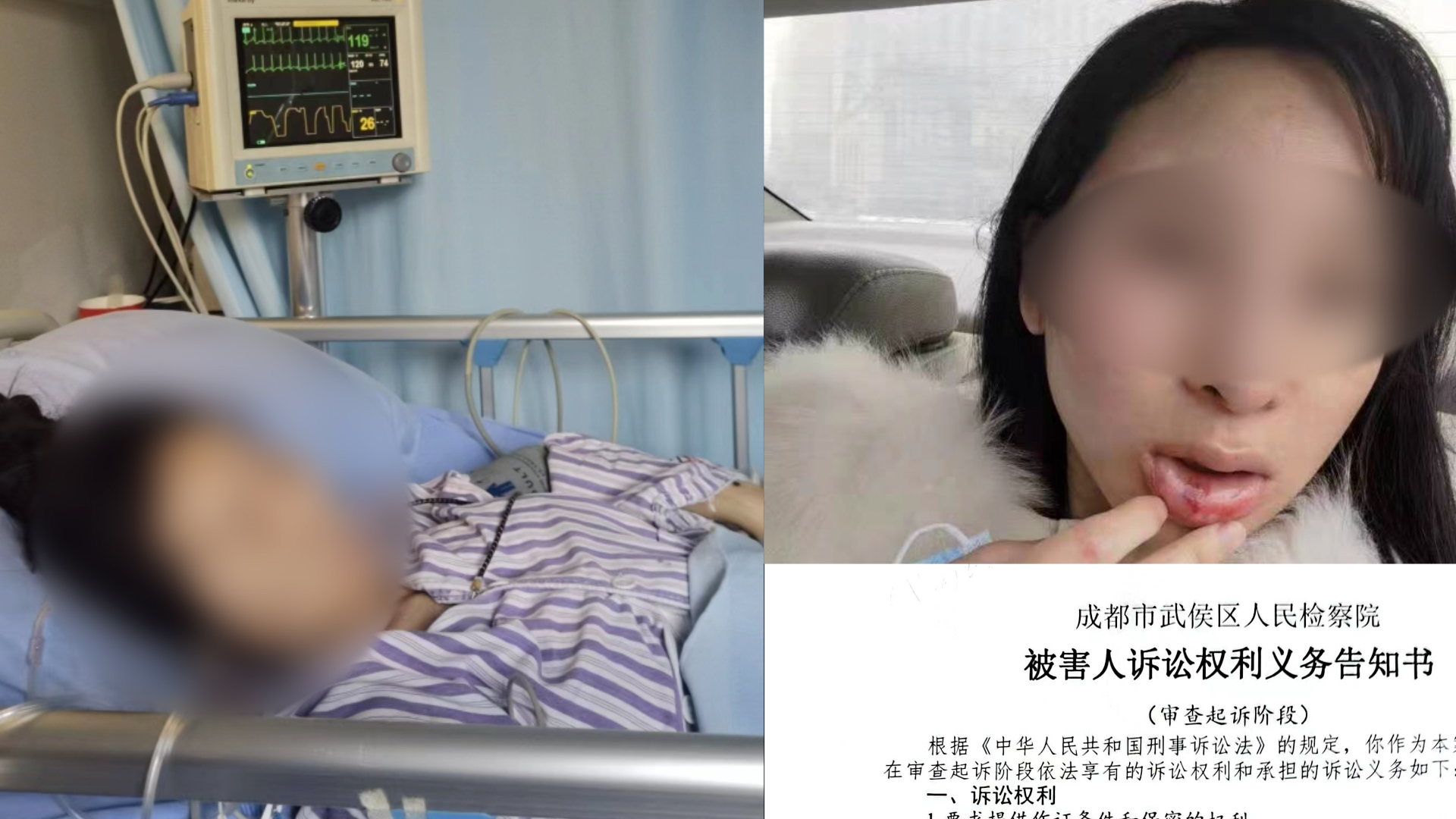 “女子2年被家暴16次案”已移交检察院,当事人:希望按杀人未遂立案重判