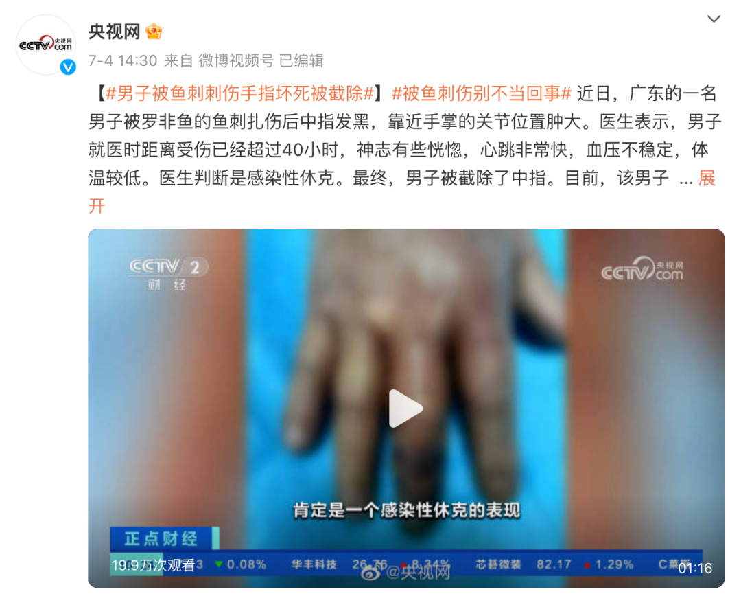 已有多人截肢或丧命！“需密切关注”