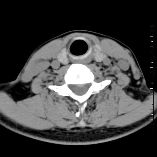 颈椎不舒服需要做什么检查ct磁共振怎么选