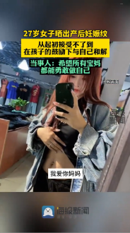 27岁宝妈与自己的妊娠纹和解了 妊娠纹一辈子都不会消失吗