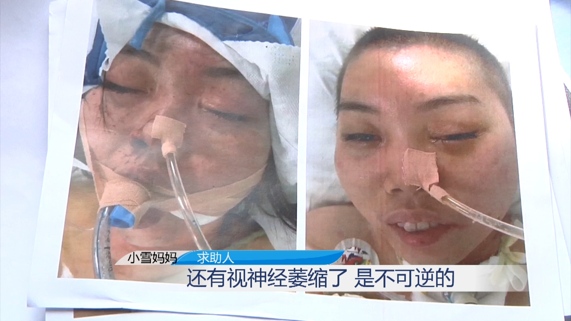 双目失明!女子新婚遭丈夫家暴,对方不付医药费还转移财产?-大象网