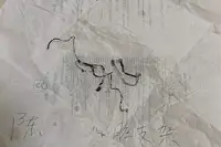 男子被一次性植入6个心脏支架后去世 鉴定医患双方同等责任