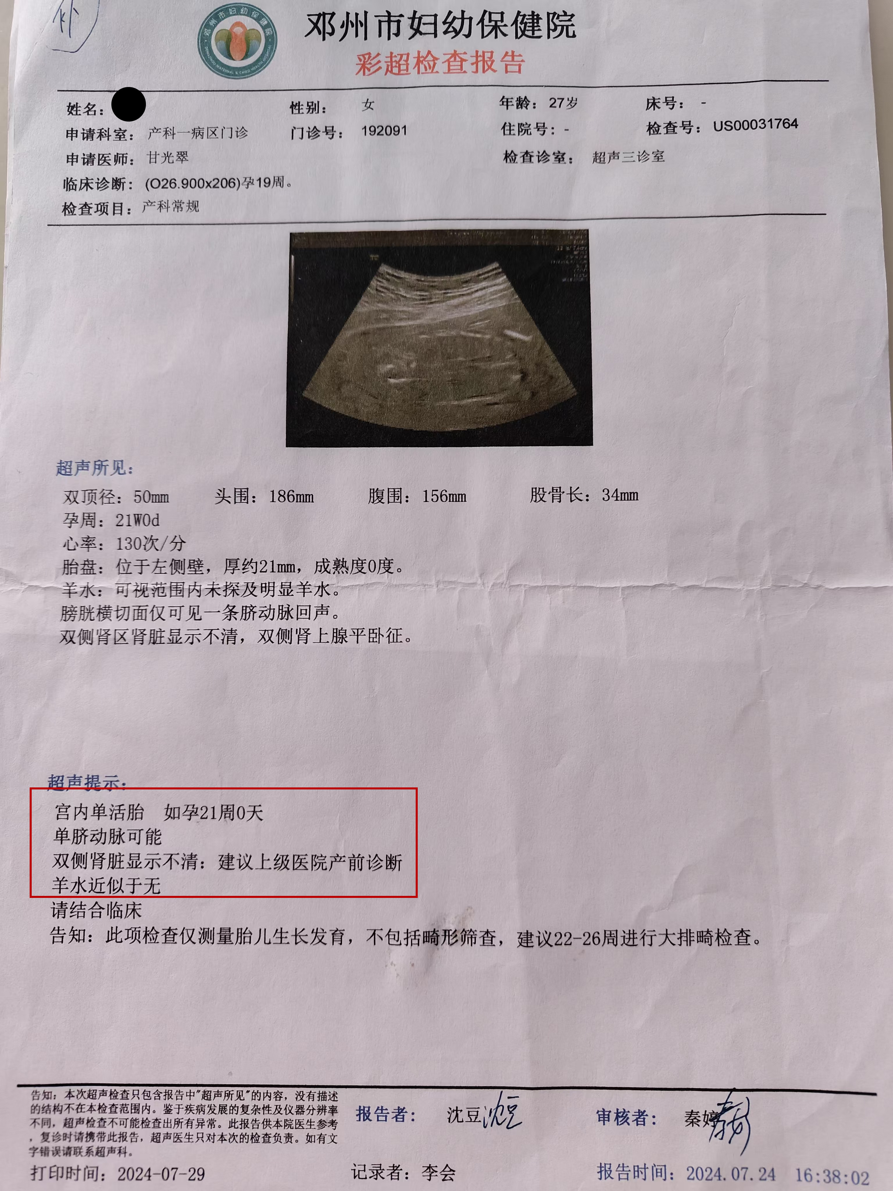 人工流产三月后 邓州女子宫内惊现"单活胎"