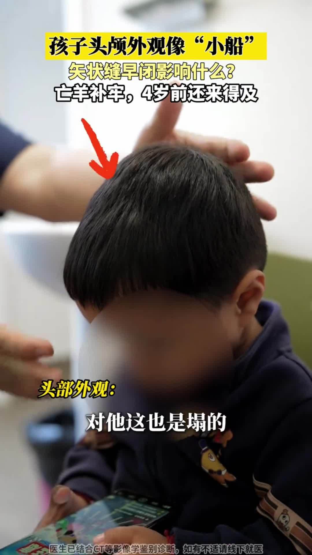 別耽誤！孩子頭顱像小船4歲前還來得及