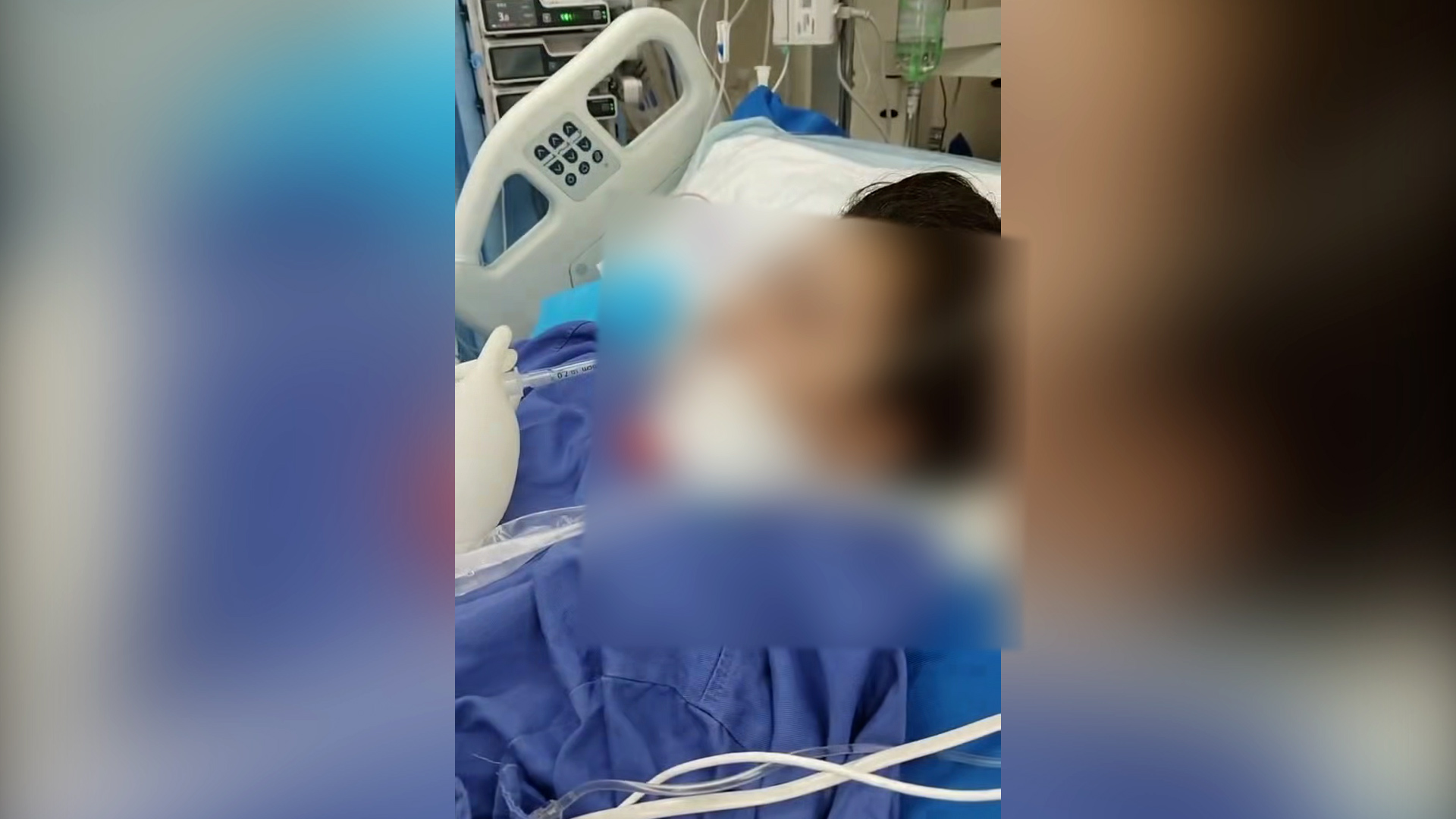 29岁女子在居民楼打瘦脸针 中毒进ICU数月花费近30万