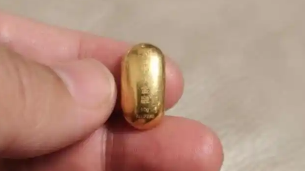 “熊孩子”误吞10克金豆！妈妈：天天叮嘱他不要在外面大便