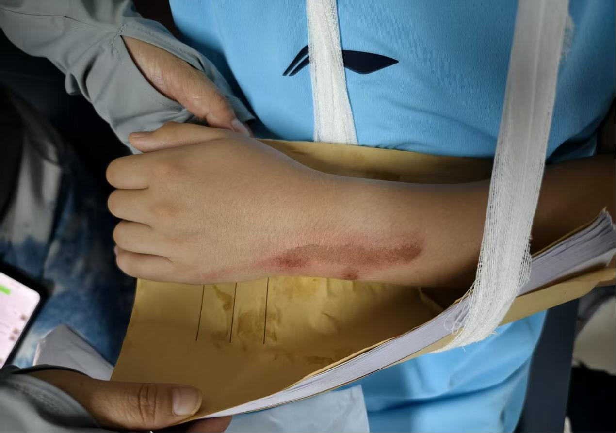 中医正骨显奇效 周口市妇幼保健院个体化治疗守护成长