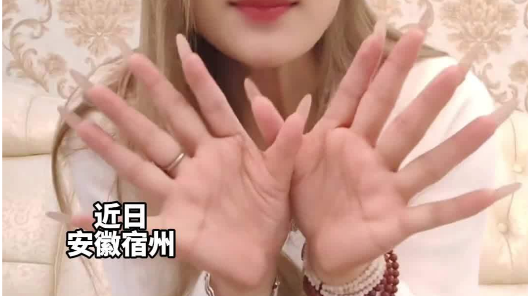 女子长12根手指自称灵活好用 悦纳自己的“不同”