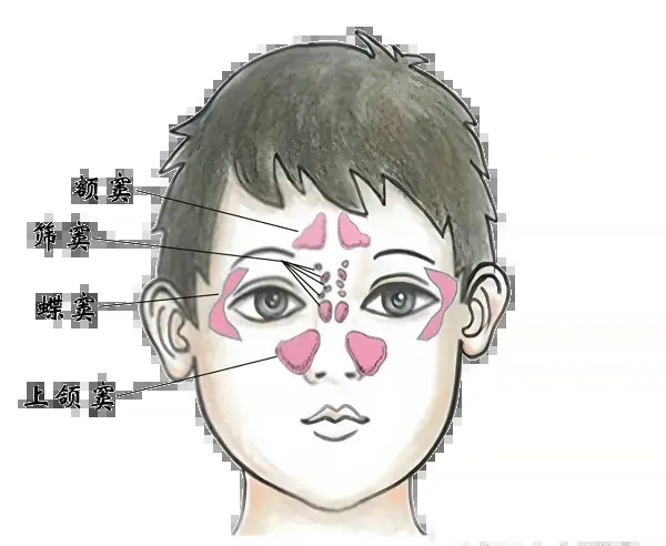 郑州民生耳鼻喉医院：流涕总不好？可能是鼻窦炎