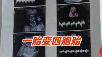 辽宁一孕妇两个月内从一胎变四胞胎，每次产检发现多出一胎