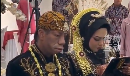 印尼一婚礼因新郎外貌爆火，五兄妹中四人因患病面容畸形