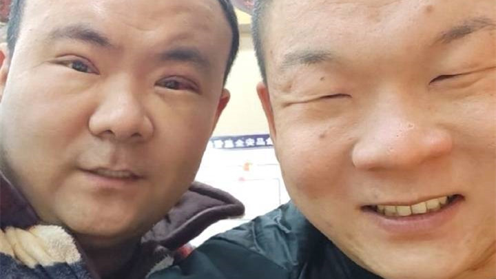 男子回应陪弟弟割双眼皮自己先割了：割完自信多了