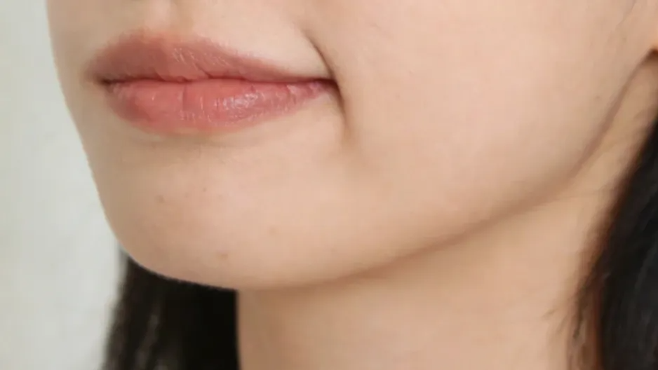 00后女生一觉睡醒，嘴歪了！硬抗44小时，一查确诊脑梗