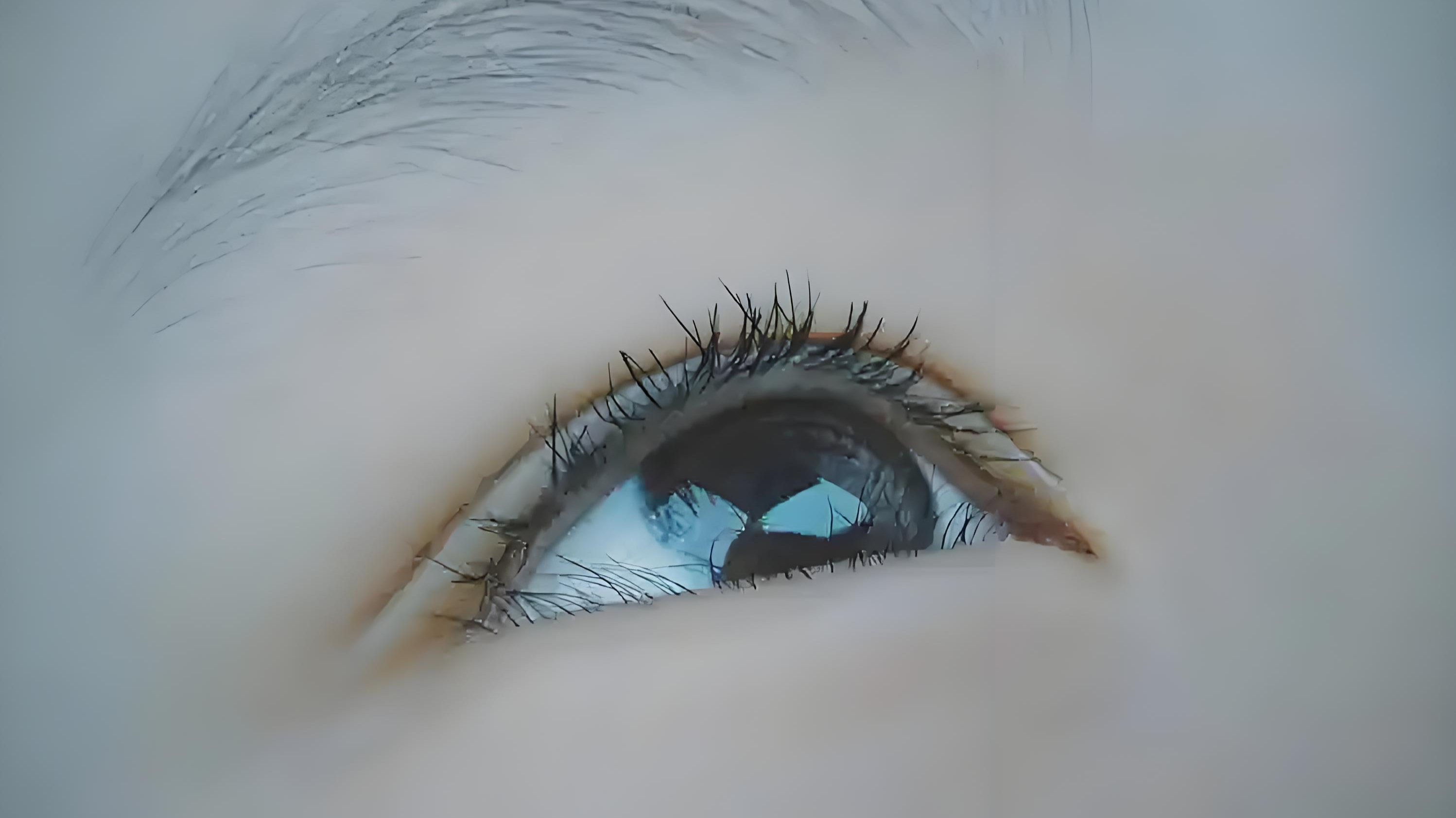 长期口渴、眼干？别大意，这种免疫病会“伪装”！