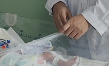 婴儿出生自带直径13厘米“大尾巴”