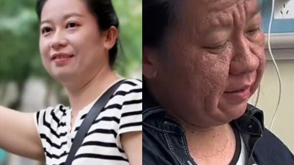 女子怀孕后相貌大变诞下女宝宝，专家：与孕妇个人体质有关