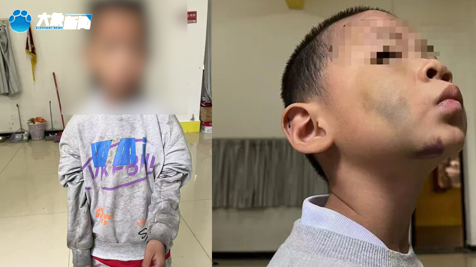 继母烫幼子下体逼吃大便 姐弟惨遭虐待生母怒讨说法