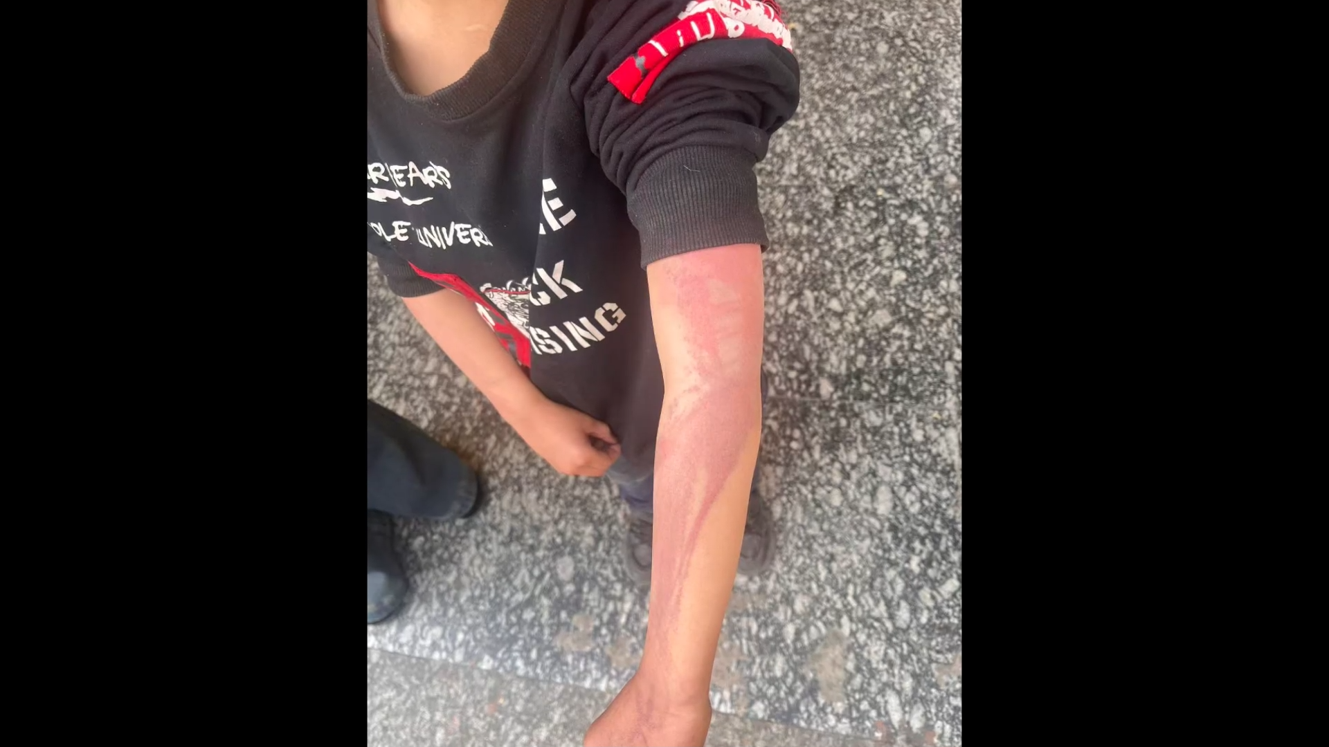 湖南虐童案：继母逼幼童吃发霉食物，不让上桌像狗一样养