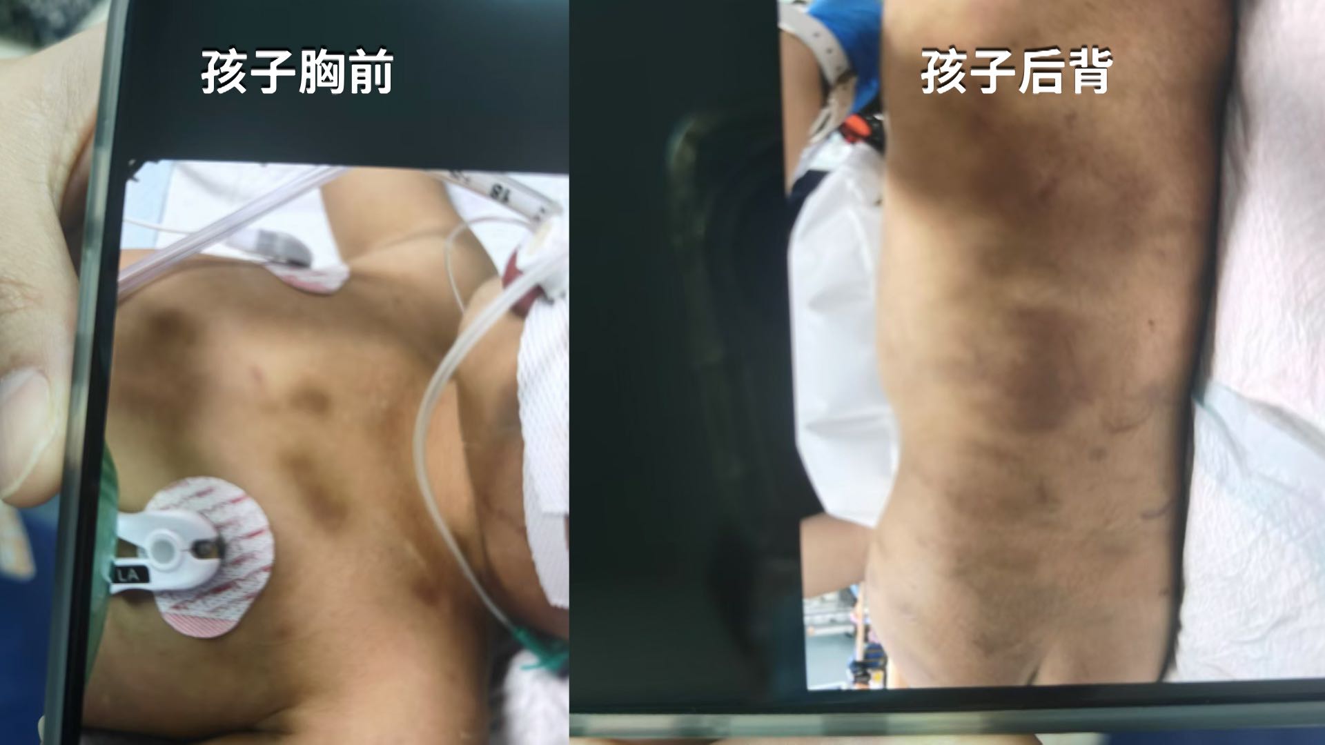 上海男童被虐致死案21日将宣判，孩子母亲：望追究生父责任