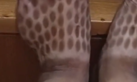 贵州一男子穿洞洞鞋出门钓鱼，脚背被晒成“珍珠奶茶”