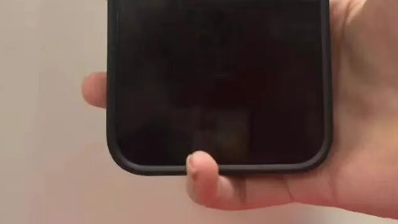 “00后”女子用小拇指托手机致关节变形