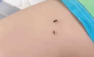 上海蚊子太多可电话投诉