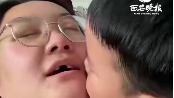 3岁儿子鼻青脸肿守护妈妈感动全网，妈妈回应：感觉对不起儿子，身体正在恢复
