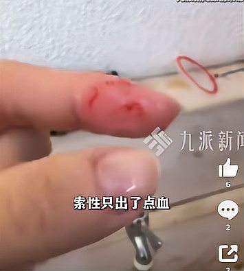 女子被加州王蛇咬住淡定冲水