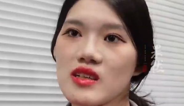 医生回应正颌后女子反成鞋拔子脸
