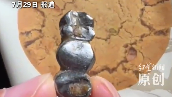 泸溪河桃酥牙冠当事人发声：山姆提出拿走涉事牙冠